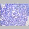 Pancreas SF 26.jpg